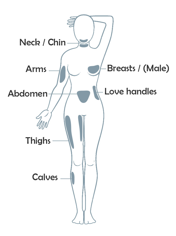 Smart liposuction body areas