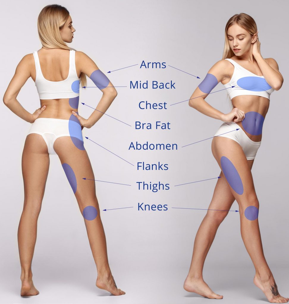 Miracle Skin Tightening Body Areas