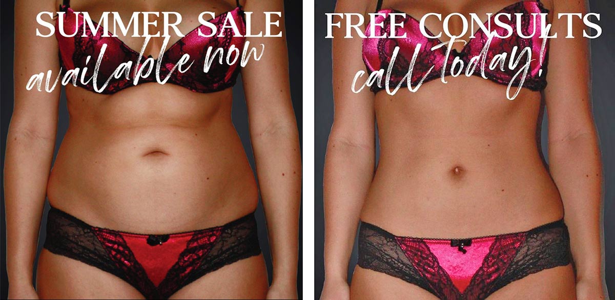 Lipo from $49 / week - Chicago Liposuction by Lift Body Center